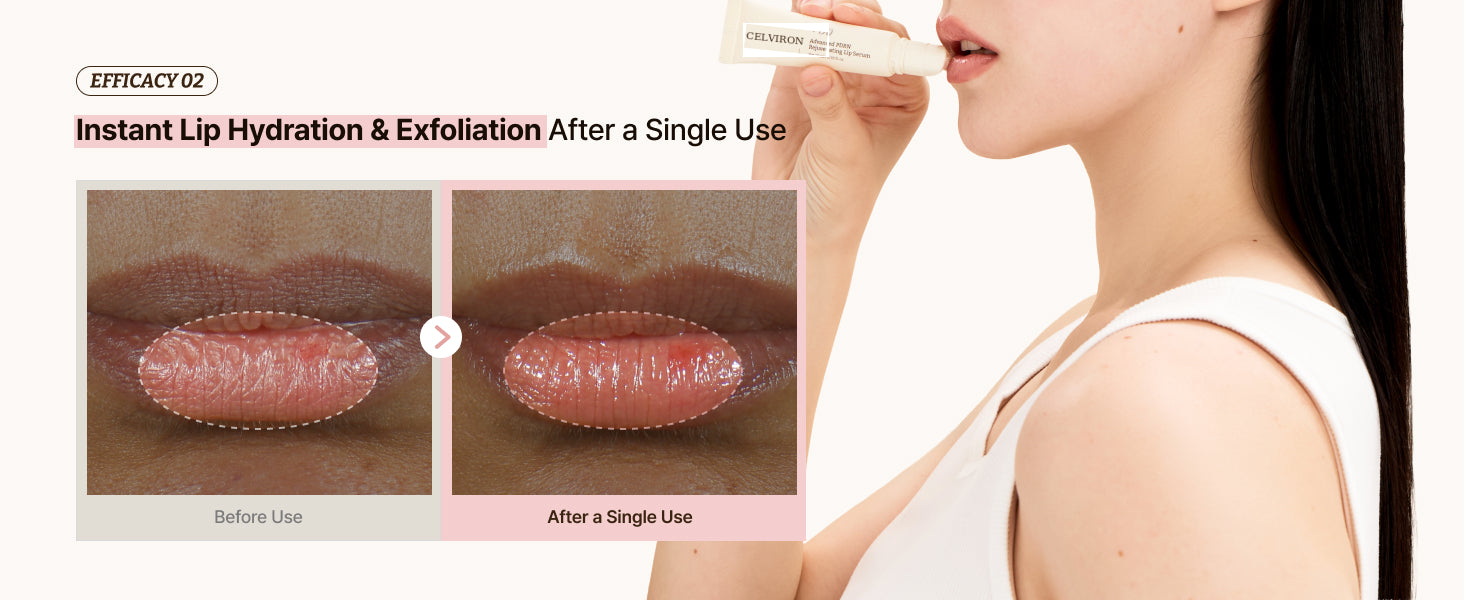 CELVIRON lip hydration and exfoliation results example