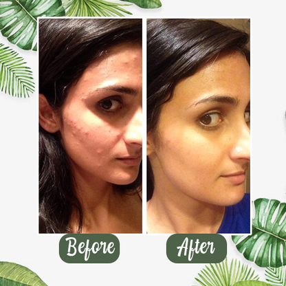 Diystar™ 100% Natural Green Tea Deep Cleanse Mask