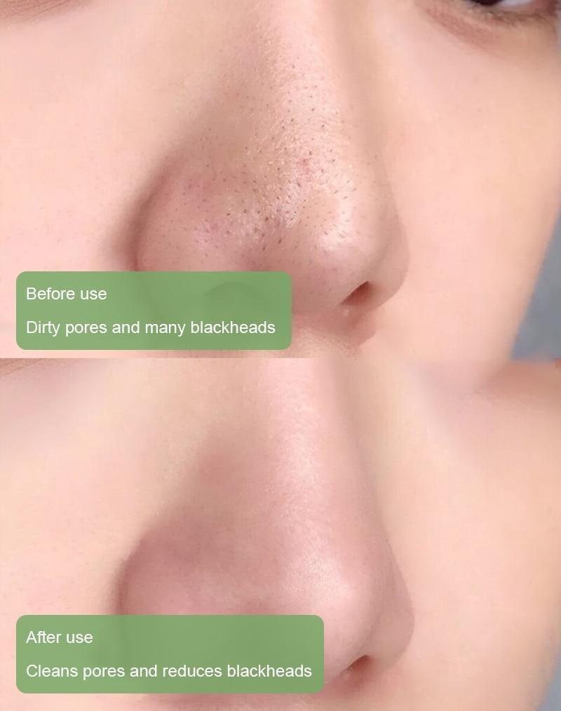 Diystar™ 100% Natural Green Tea Deep Cleanse Mask