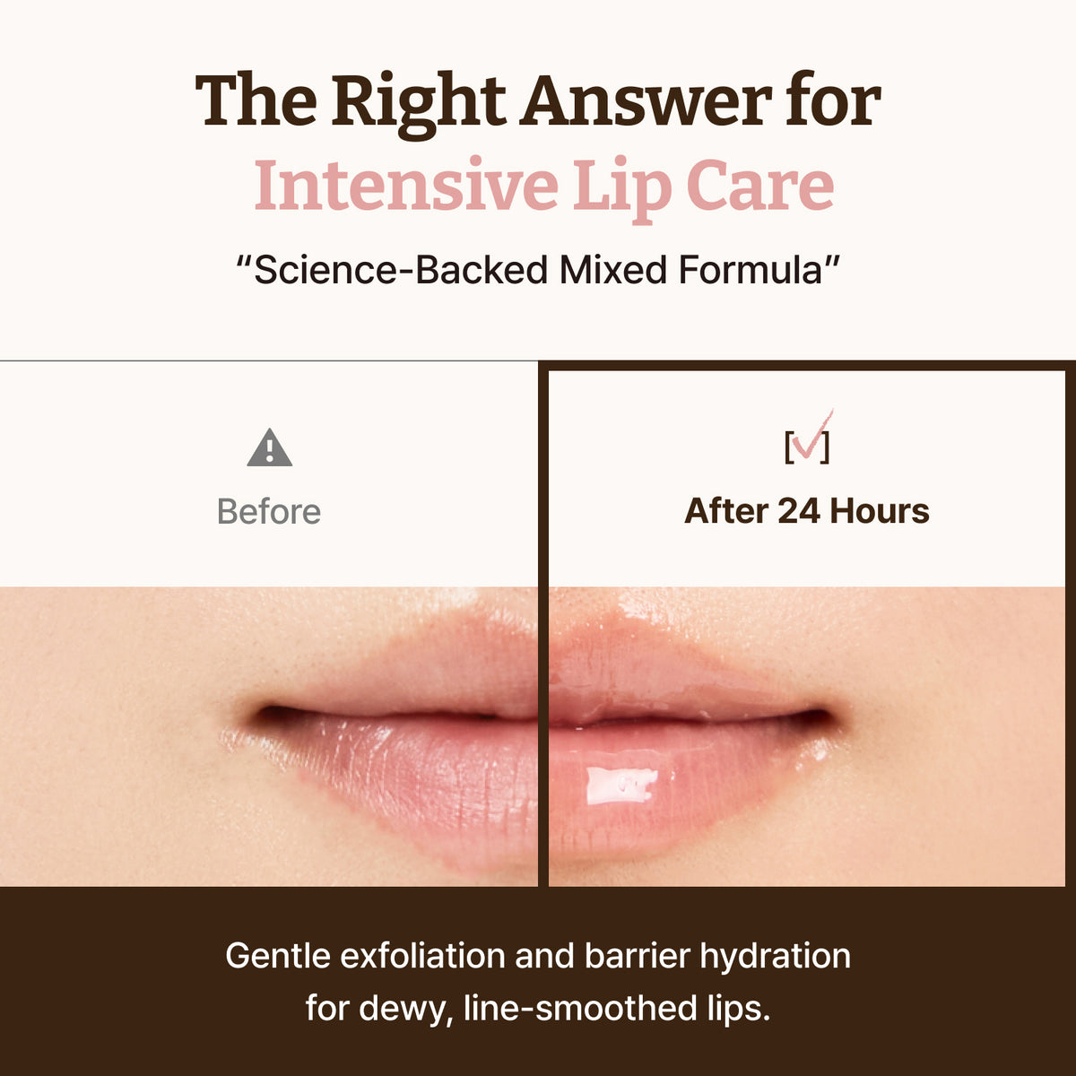 Celviron™ PDRN Lip Serum — The Gloss That Cares Back