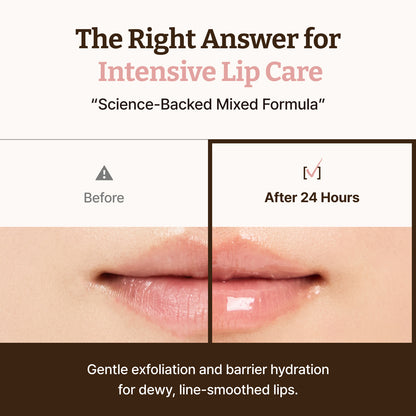 Celviron™ PDRN Lip Serum — The Gloss That Cares Back