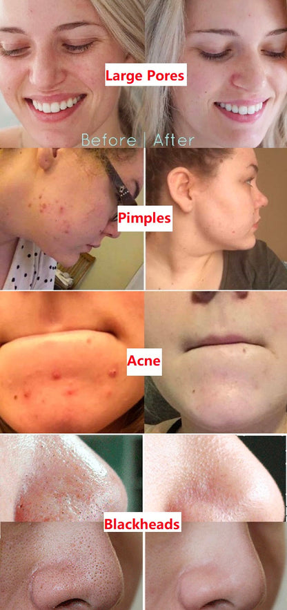 Diystar™ 100% Natural Green Tea Deep Cleanse Mask