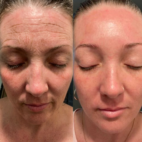 Resultado de Jessica R., Belo Horizonte, 45 anos, mãe de dois