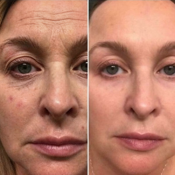 Resultado de Megan L., Curitiba, 43 anos, designer