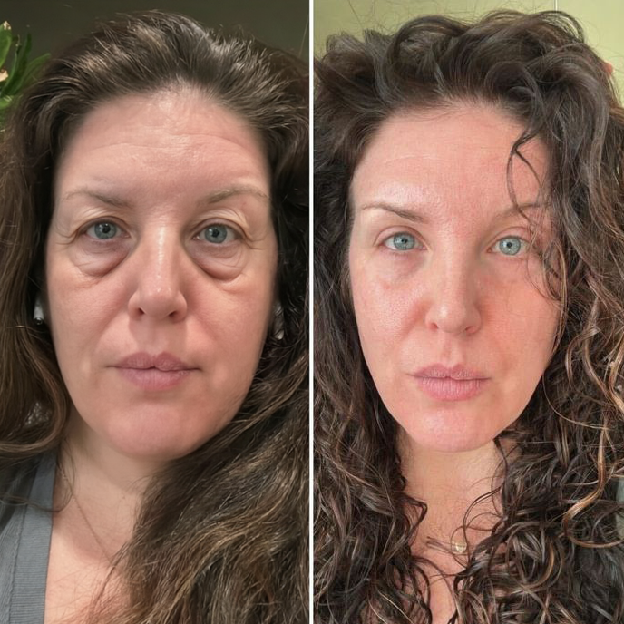 Resultado de Laura K., São Paulo, 51 anos, professora