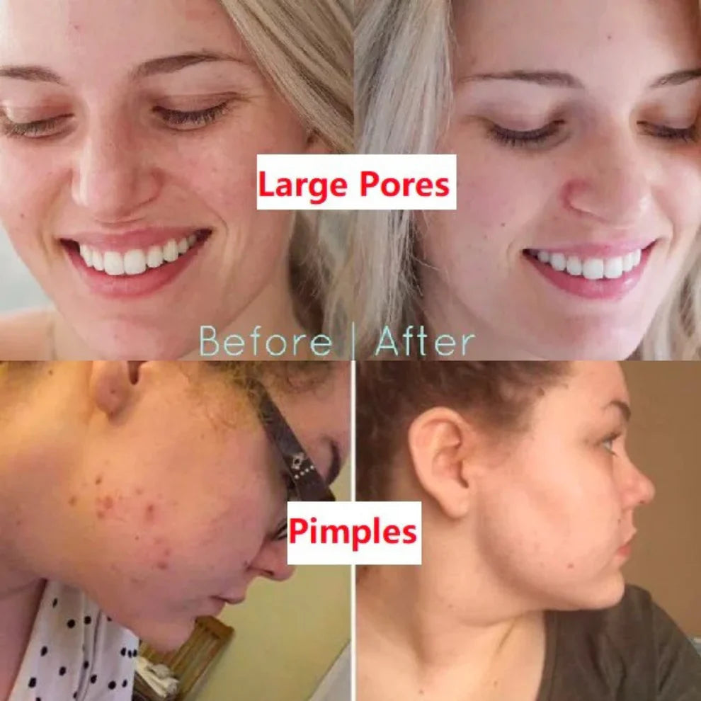 Diystar™ 3-in-1 Multi-Action Formula Deep Cleanse Mask